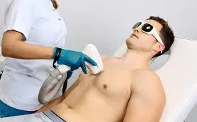 Depilación láser masculina: precisión clínica en zonas pequeñas que marcan la diferencia